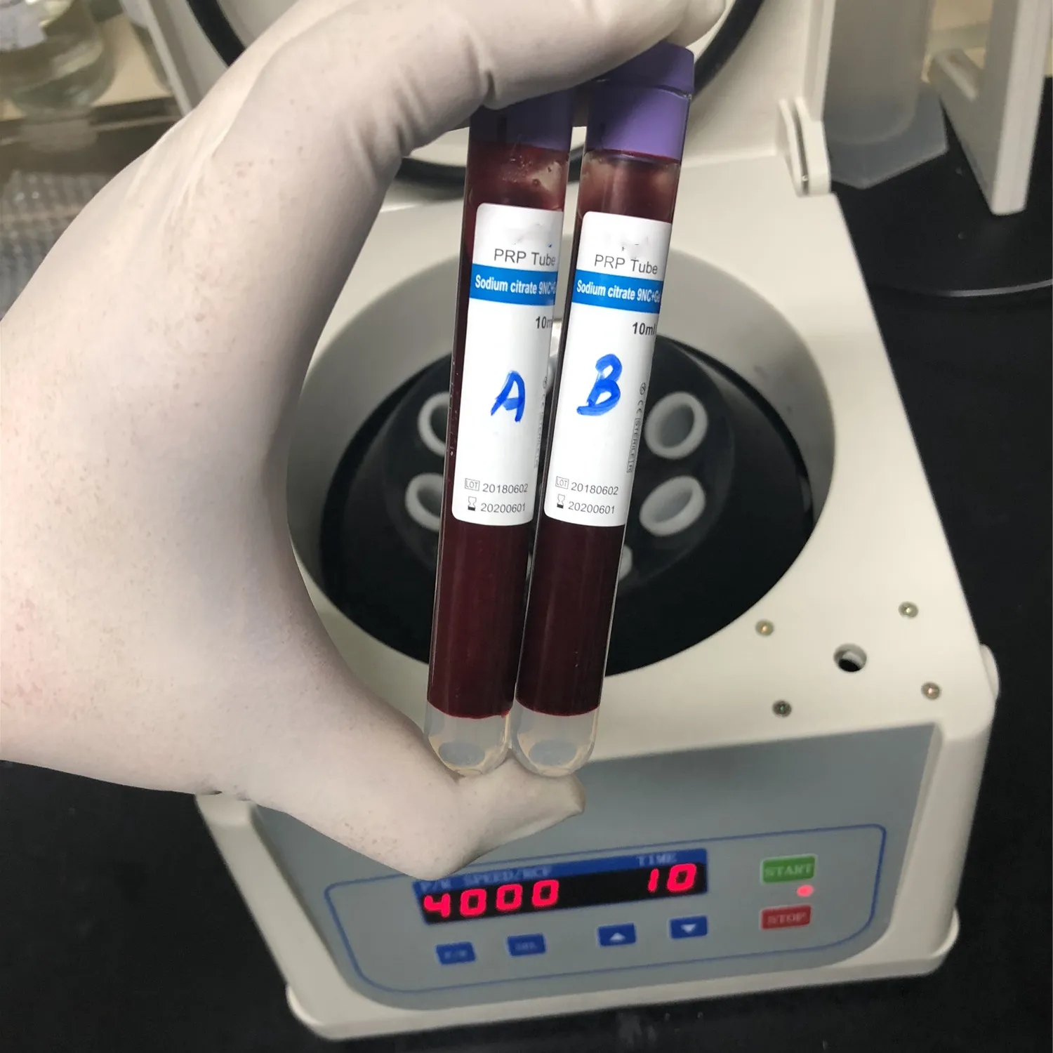 Centrífuga de Plasma rico en plaquetas, máquina de terapia PRP para sangre, venta al por mayor