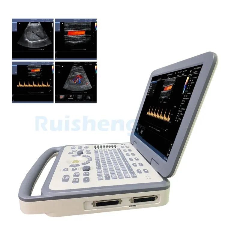 RS-N30 profissional melhor máquina de ultrassom portátil da china sistema de scanner doppler de cores
