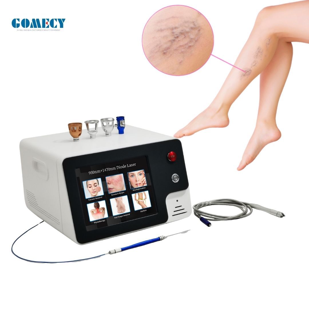 Veins removal