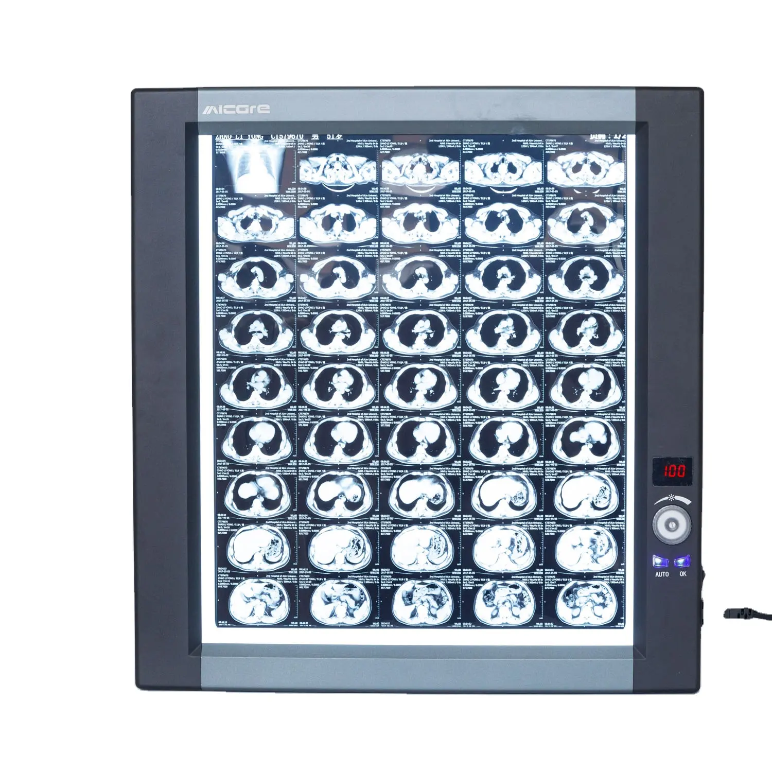 Visualizador de raios x led negatoscópio médico, x-ray filme, negatoscópio