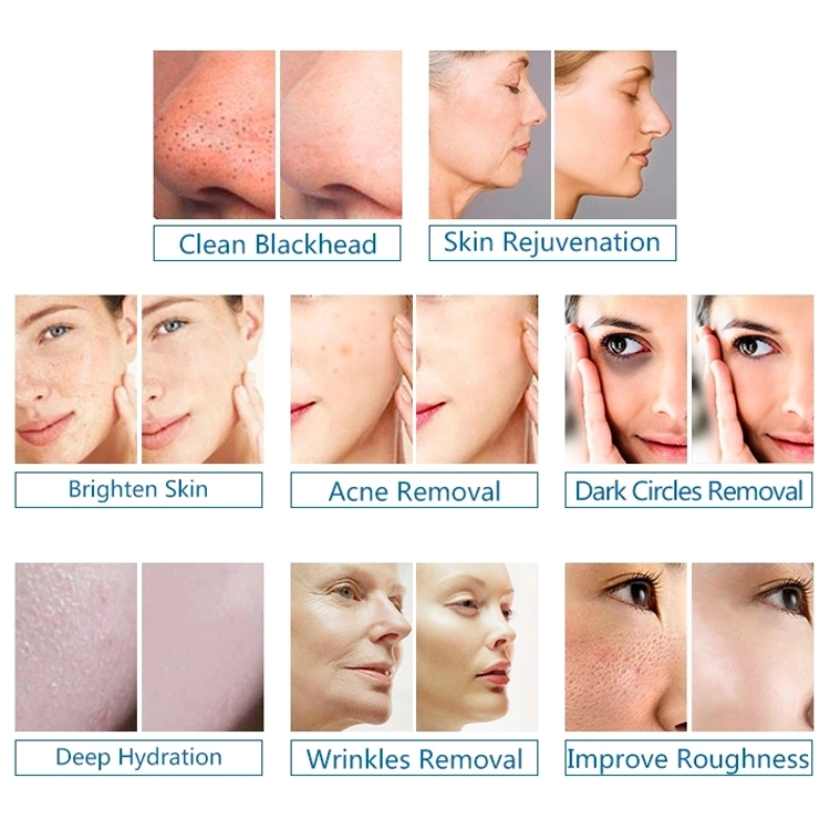 Korea Oxgyen Dome Face Care Machine Skin Care Equipment With Pdt Led Light Therapy Skin Rejuvenation Wrinkle Removal