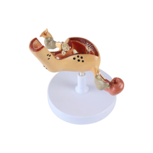 医学モデルの工場人間解剖学的病理学子宮モデル - Product Image 5