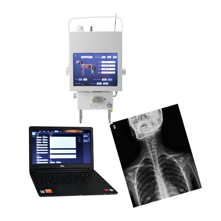 Equipamento médico da radiologia do preço da máquina de raio x digital do hospital da radiologia 630ma