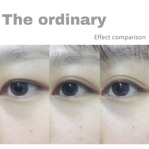 สารละลายคาเฟอีนธรรมดา30มล. 5% + เซรั่มบำรุงรอบดวงตา EGCG สำหรับขจัดอาการบวมและรอยคล้ำ - Product Image 6