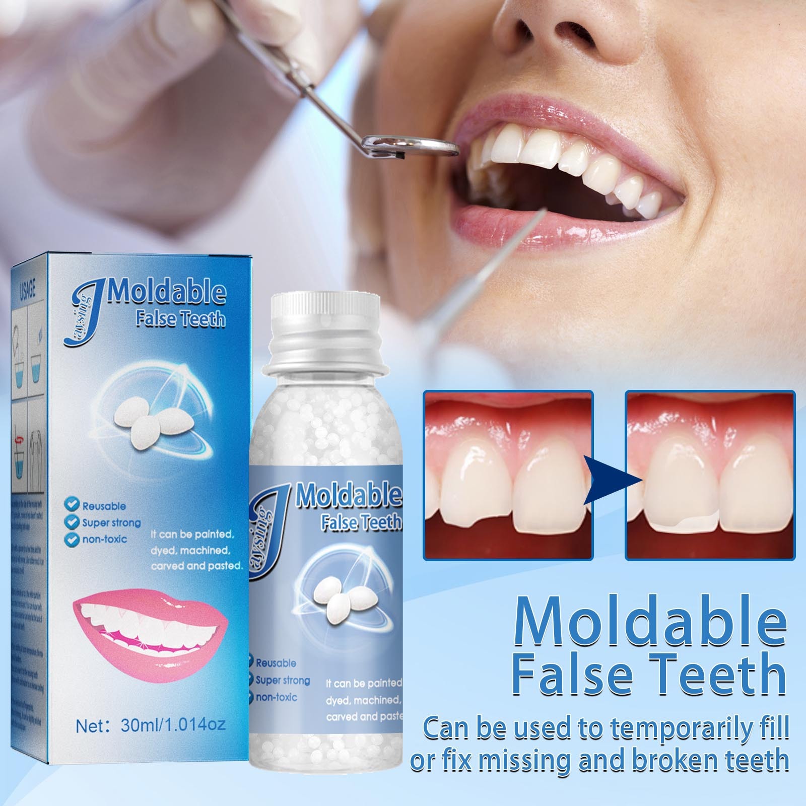 Blanqueamiento dental