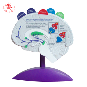 Epilepsi modeli İnsan beyin patoloji modeli anatomik eczane hediye - Product Image 6