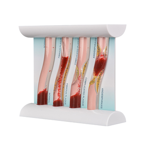 Özelleştirme için dört aşamalı kan damarı tıkanıklığı modeli - Product Image 4