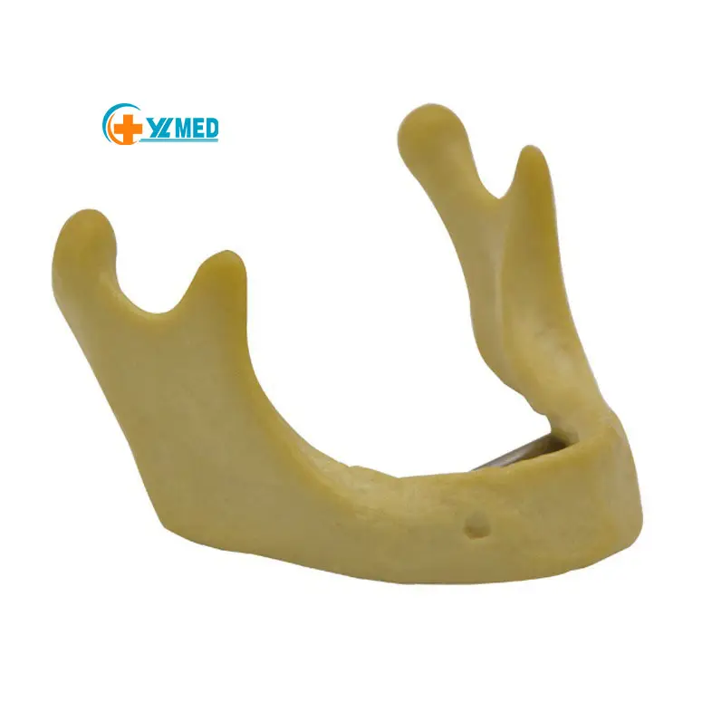 Equipamento de materiais didáticos para implante mandibular biônico, modelo de consumíveis orais para ortopedia óssea e mandíbula de medicina dentária