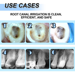 ग्लिन एंडो फ़ाइलें गर्मी सक्रिय निटी नीले रोटरी बेबी डेंटल ड्रिल उपकरण और सहायक उपकरण बाल चिकित्सा दंत चिकित्सा दंत ड्रिल और सहायक उपकरण - Product Image 5
