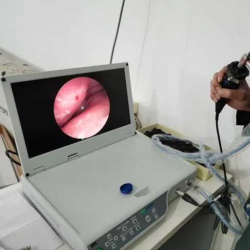 Endoscopio medico laparoscopia macchina fotografica