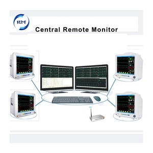 ETCO2 Monitor de seis parámetros para sala de operaciones Impresora de pantalla táctil opcional Aparatos obstétricos para uso humano - Product Image 6