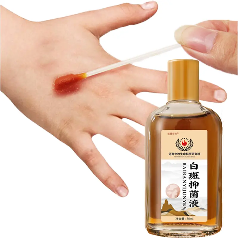 most popular products White spot antibacterial solution Promoting melanin Suitable for people with melanin white spots