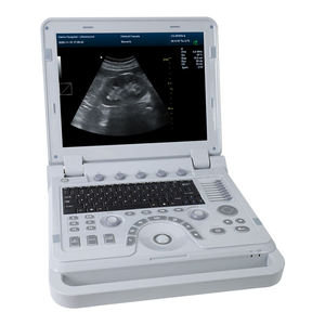 CONTEC CMS1700A便利な人間の医療画像用の医療用超音波デバイス - Product Image 2