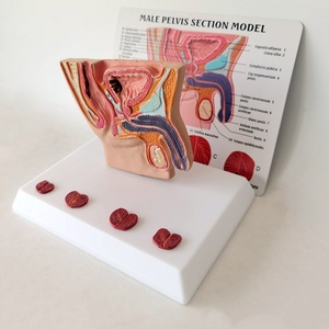 Human Male Abdominal Cavity Bladder Prostate Health Disease Comparison Medical Teaching Doctor-Patient <strong>Explanation</strong> Model - Product Image 6