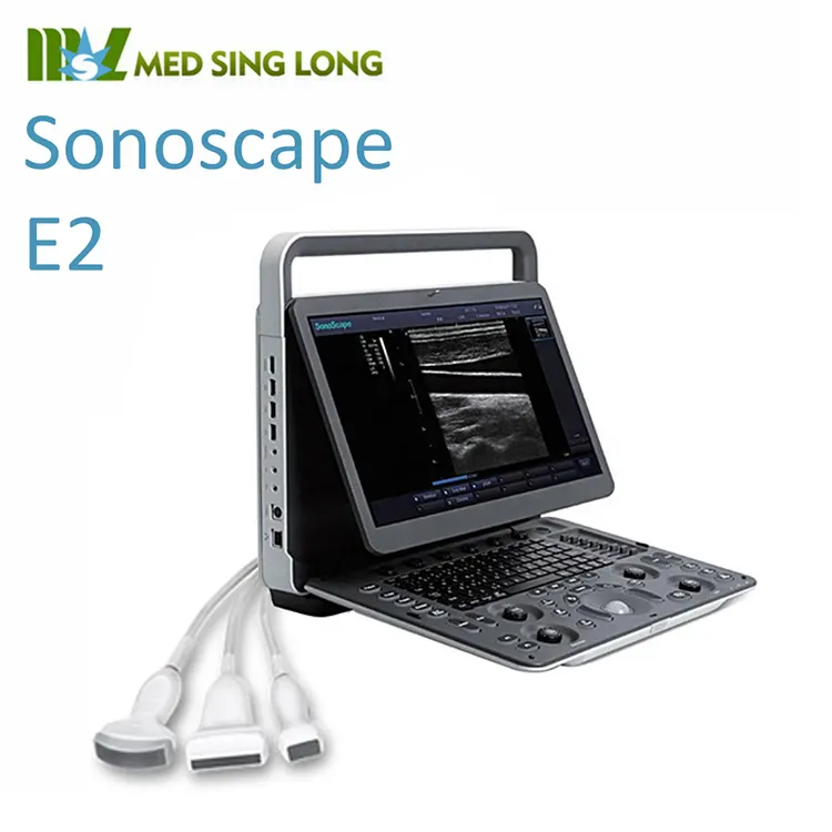 Sonoscope E2pro machine à ultrasons, doppler couleur, USG avec fonction TDI CW PW