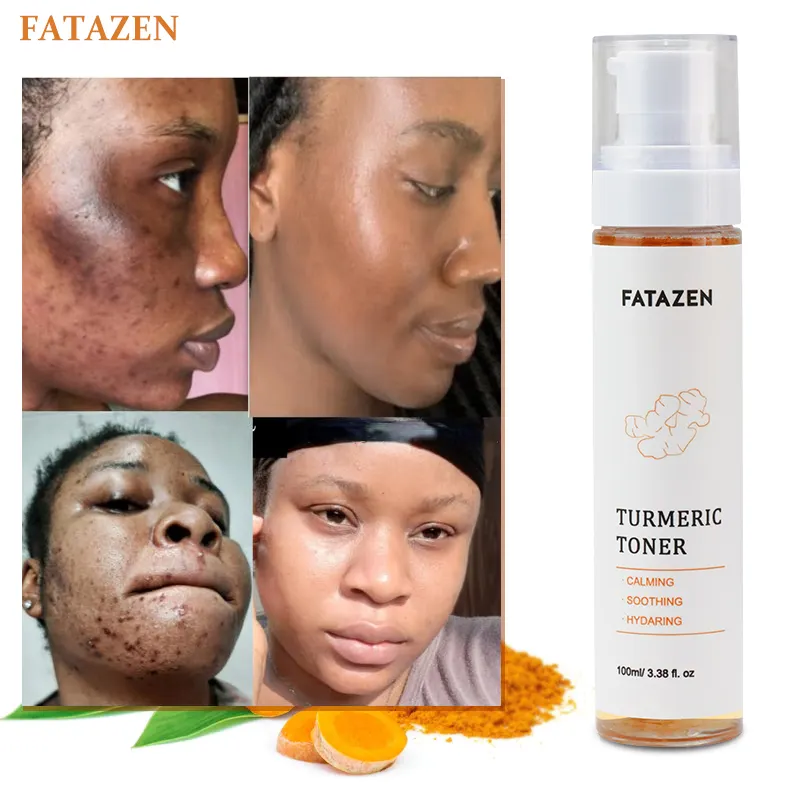 Clareamento facial de turmeric orgânico natural, tonificador e hidratante com vitamina c para a pele, para cuidados com a pele