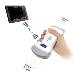 CONTEC CMS1600B便携式彩色多普勒超声诊断机凸/线性双探头 - Product Image 2