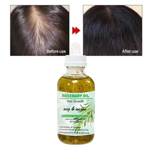 Organik anti-saç dökülmesi tedavisi biberiye saç büyüme yağı Serum hindistan cevizi yağı tabanlı zulüm-ev kullanımı için ücretsiz - Product Image 2