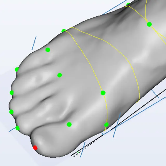 Escáner de color de cámara 3D y ordenador para calzado ortopédico