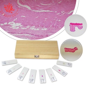 Microscópio Humano Preparado <span class=keywords><strong>Slides</strong></span> 50 Tipos Hematoxilina Esosin Mancha Ensino Recurso Capa Redonda Deslizada Histologia <span class=keywords><strong>Slides</strong></span>