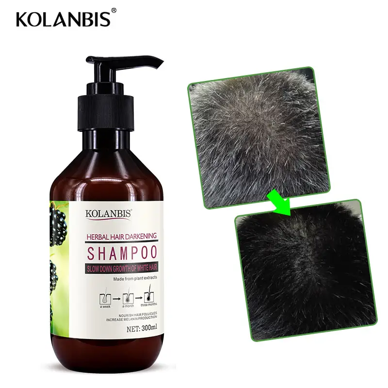 Amazon vendedor top anti cinza cabelo preto shampoo para cabelos brancos tratamento médico a partir de raiz de 300ml