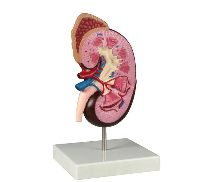 Human Plastic Kidney Anatomic Model