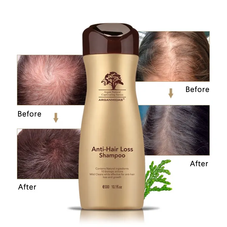 Tratamento de crescimento capilar natural, alopecia anti dandruff shampoo cura para afinamento do cabelo