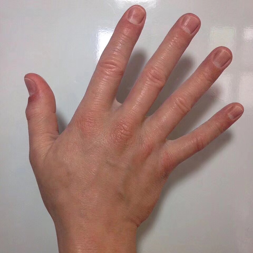 natural skin color
