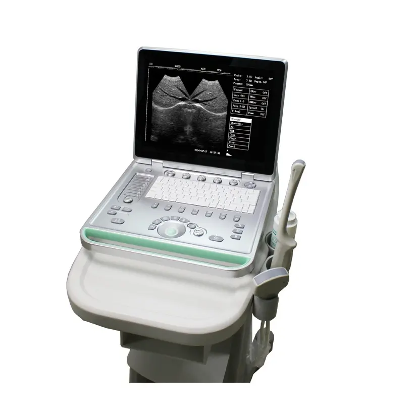 Macchina ad ultrasuoni per Laptop macchina ad ultrasuoni doppler a colori 3d in vendita strumenti ad ultrasuoni medici