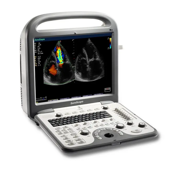 Sonosape-ultrasonido S8 para biavión BCL10-5, sonda de uroología, Médicos en hospital