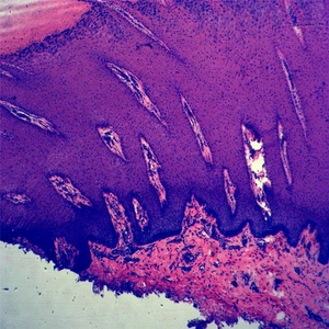 Patología Oral histología prepared slides para microscopio - Product Image 3