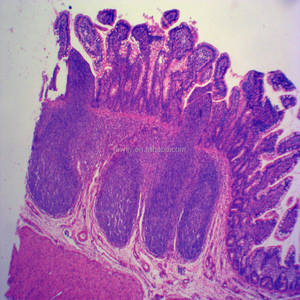 Deslize histológica humana, deslize patógicas preparadas para tiras 7101 de microscópio
