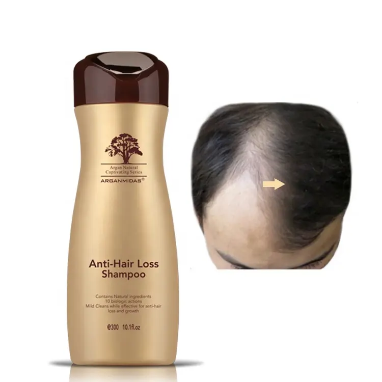 Arganmidas Anti Hair Fall Products Herbal Hair-Loss Prevention Jengibre Champú para el crecimiento del cabello