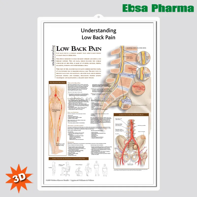 Pannelli Murali 3D Medico di Anatomia Umana/Poster-Comprensione Mal di Schiena