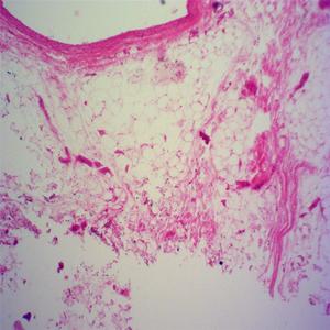 Heißer verkauf vorbereitet folien für histologie 1000x usb digital mikroskop mit niedrigem preis