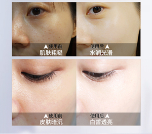 プロの女性の顔クリームダークスポット除去ホワイトニングそばかすクリーム - Product Image 3