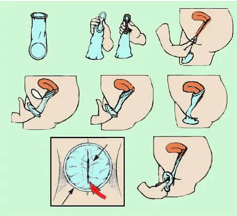 건강 관리 용품 섹스 제품 풍미의 종류 사진 여성 콘돔 소녀 콘돔