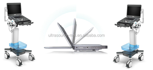 Sonosape X5 Blue-Tooth Siêu Âm 3d Doppler Siêu Âm Giá Máy/Máy Siêu Âm 3d 4d - Product Image 5