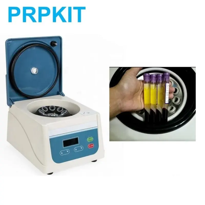 PRP צנטריפוגה צינור 8ml 10ml 12ml 15ml דם prp צנטריפוגה צינור מכונה