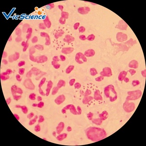 100 tipi di microscopio umano educativo istologia patologica vetrini preparati scivolo istologico - Product Image 3