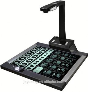Joyusing CT160 X-Ray Film <strong>Scanner</strong> for Hospital and Clinic Diagnosis