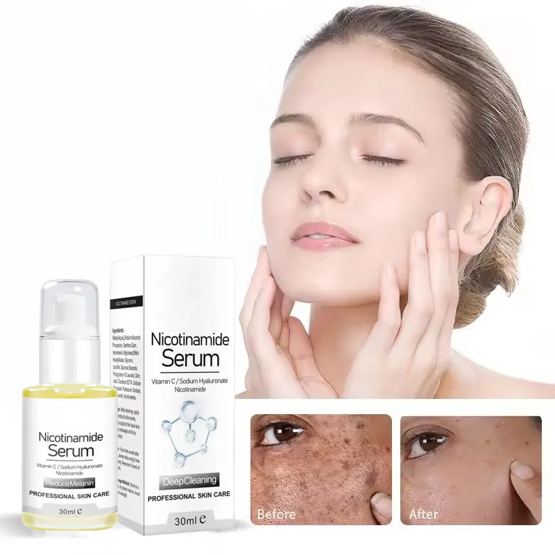 Oem Hàn Quốc chống lão hóa axit hyaluronic Niacinamide mặt chăm sóc da Retinol Vitamin C huyết thanh cho khuôn mặt