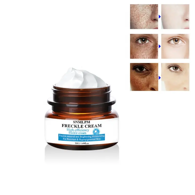 Alta eficiencia 30g Etiqueta Privada orgánica cuidado de la piel crema facial hidratante brillo Crema para eliminar pecas