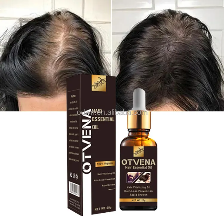 Melhor 100% Private Label Vegan Natural Orgânico Rose Mary Óleo de cabelo ayurvédico Rosemary Anti-Coceira Scalp Massagem Óleo