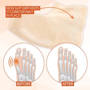 Kaymaz kavrama Bunion çorap ile kabartma ortopedik çorap ped kol atel jel koruma tutucu - Product Image 2