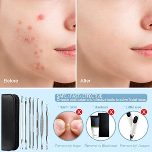 All-in-One mũi mụn đầu trắng nhíp comedones extractor mụn trứng cá Zit 5 6 8 9 10 pcs mụn đầu đen Remover 7 trong 1 mụn Popper công cụ Kit - Product Image 6