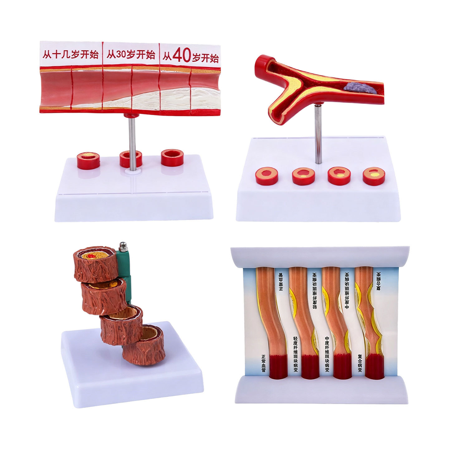 Four-piece set