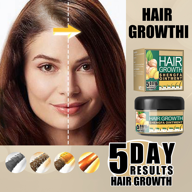 hot sale natural hair loss treatment solution 5 days ginger hair growth ointment 30g hair growth cream