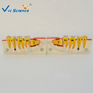 Mô hình giáo dục nha khoa mô hình răng người mô hình khoa học y tế ngay dưới buccal răng và tổn thương sâu răng - Product Image 2