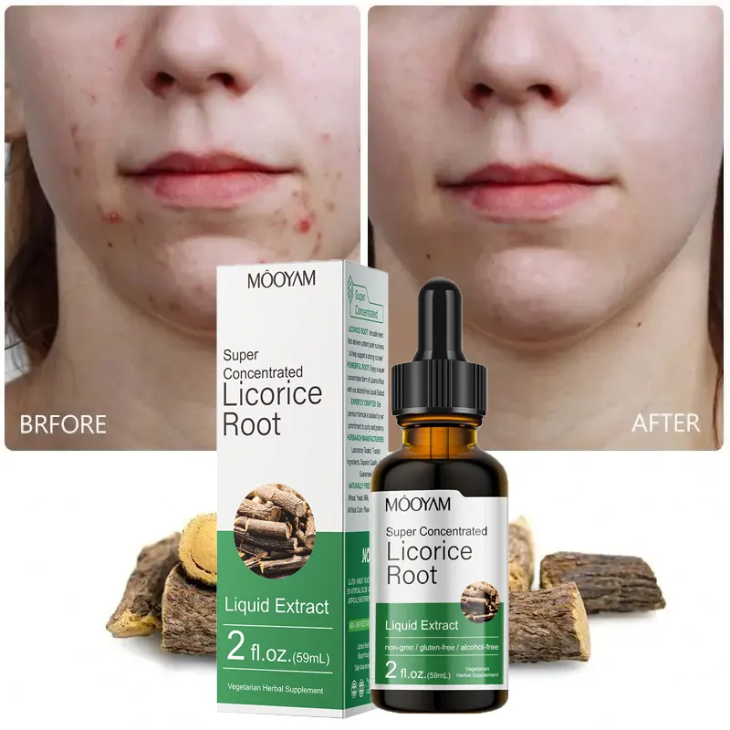 Beauty Herbal Licorice Root Serum Anti Inflammatory Facial Whitening Moisturizing Anti Acne Serum For Face